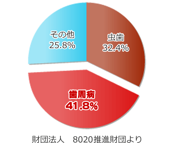 歯周病・歯槽膿漏 | 高知 安光歯科 | いの町の歯医者さん