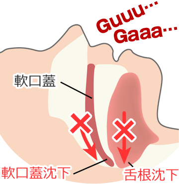 睡眠時無呼吸症候群 高知 安光歯科 いの町の歯医者さん